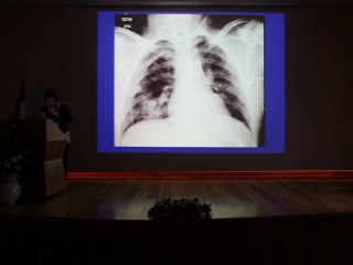 Supine Chest Films Pitfalls - Dr Yehudit ROZENMAN Part 2