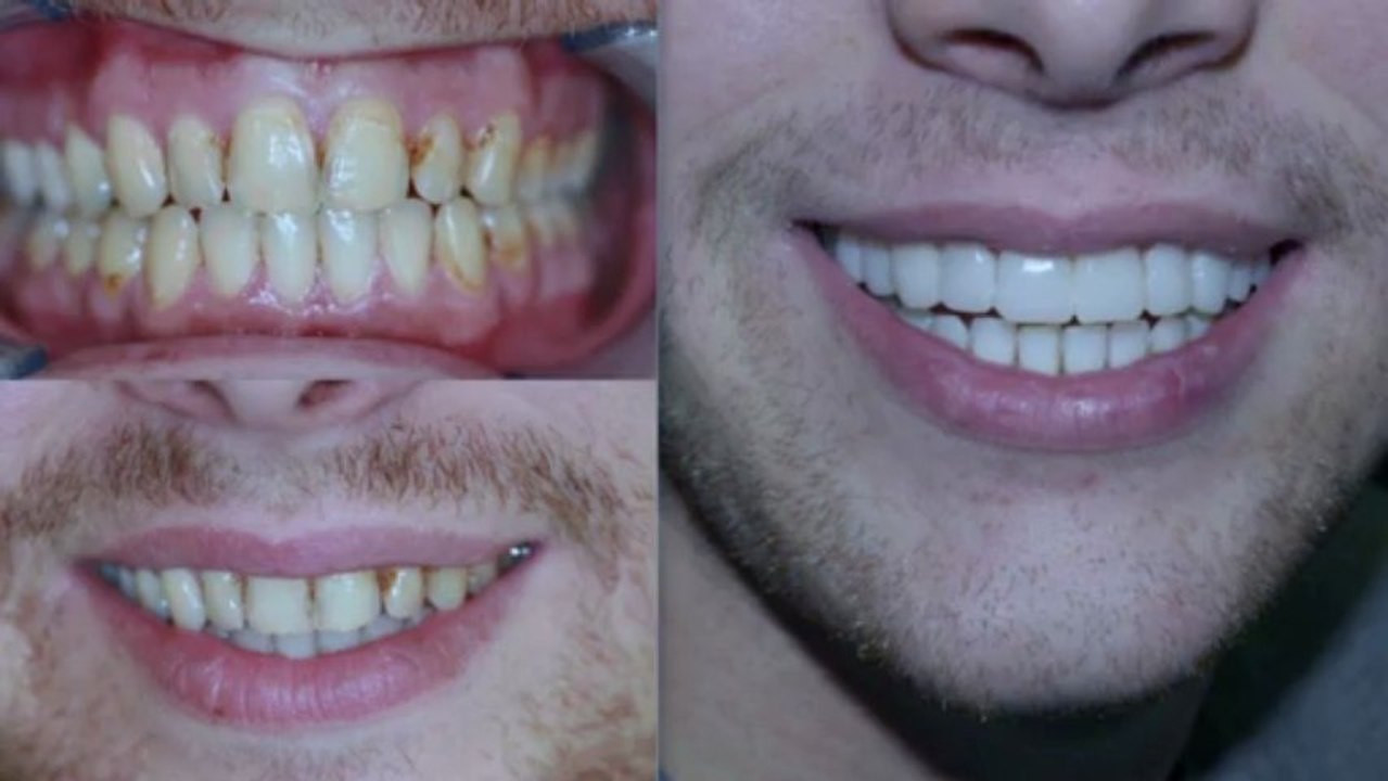 dentist in bury