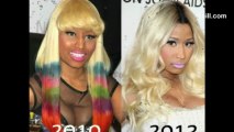 Nicki Minaj Plastic Surgery Over The Years. The Before & After Pictures!