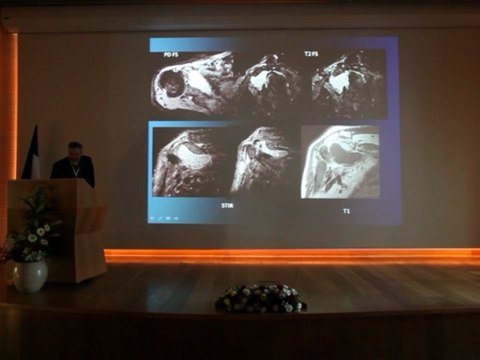 MSK Imaging cases - Pr Nogah HAMARATI