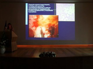 Benign & Malignant lesions of the pleura - Pr Marie-Pierre REVEL