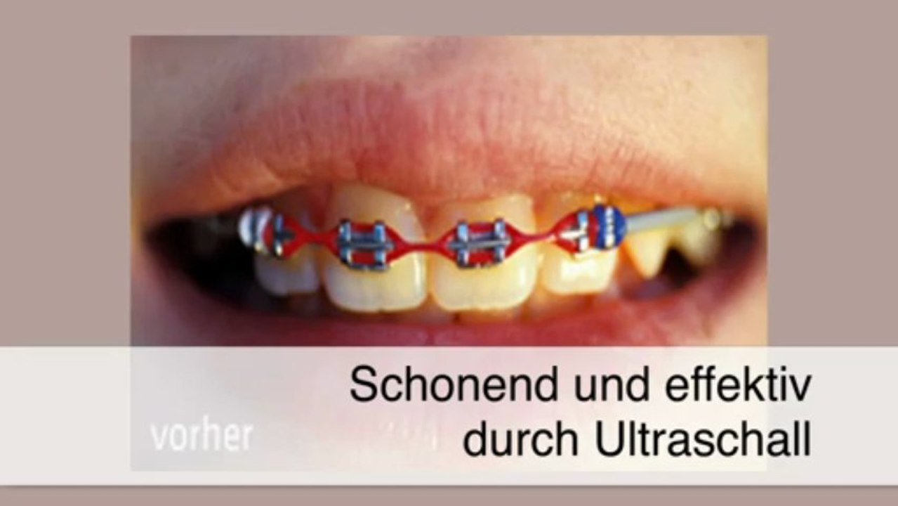 Zahnbürsten - Bielefeld FDR InnoKom