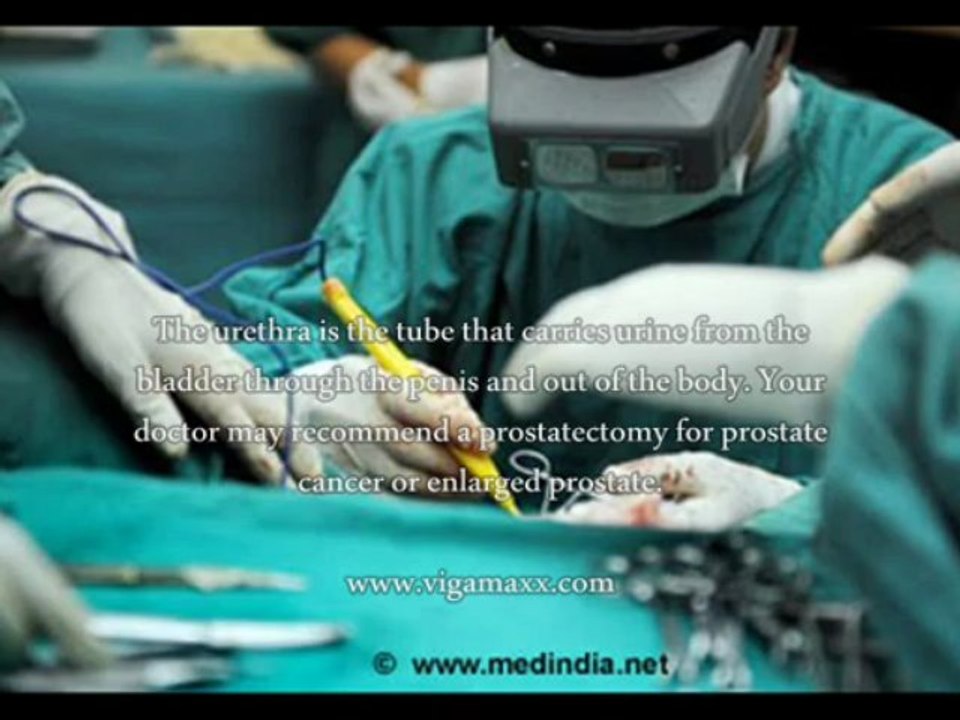 Prostate Removal Open Surgery What Is Prostate Removal Open Surgery? video Dailymotion