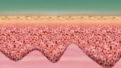 Alma Lasers iPixelRF