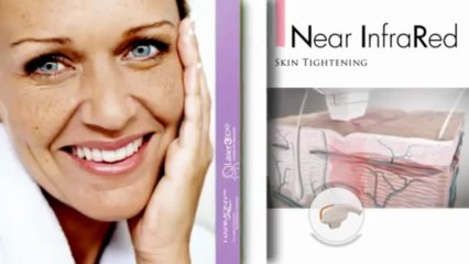 Laser360iQ by Alma Lasers Ltd.