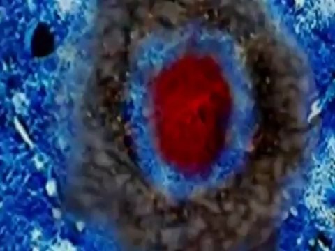 Gerald Schell MD - Alzheimers Disease