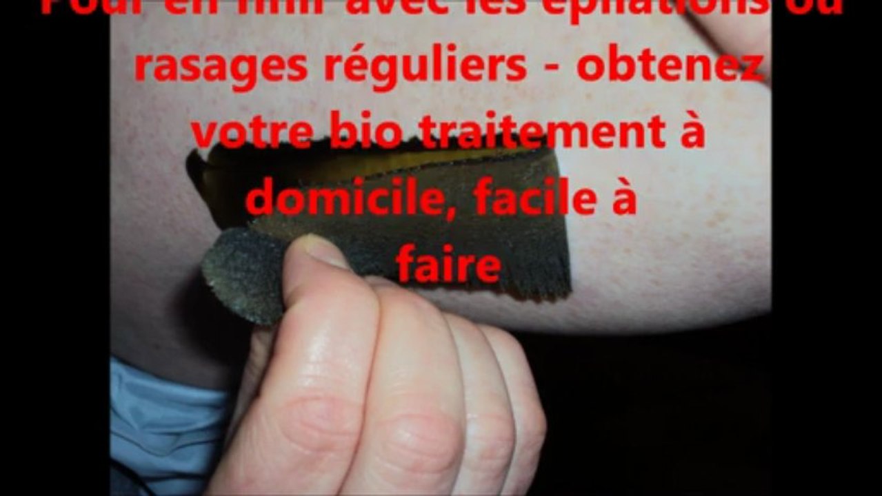 Epilation définitive progressive, pour elle et lui