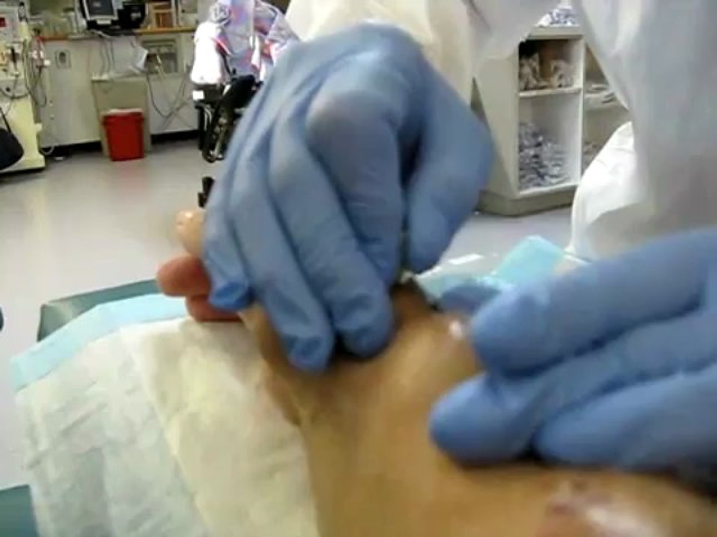 ⁣Kidney Dialysis Overview