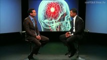 Stroke Essentials : Doctors Chat : MD-VOD