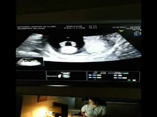 Echographie 1er trimestre: Jennifer et Damien