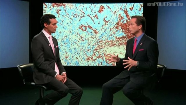 Breast Cancer : Doctors Chat : MD-VOD
