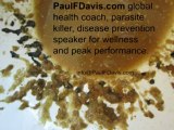 Disease Prevention Speaker - East Africa Parasites - Parasite Cleanse