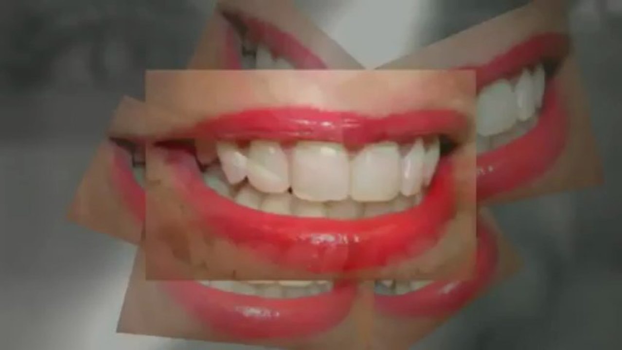 Como encontrar seu dentista em Porto Alegre para Tratamento de Canal