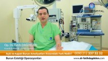 Açık ve kapalı burun ameliyatları arasinda ne fark vardır? Op.Dr.Fatih Dağdelen