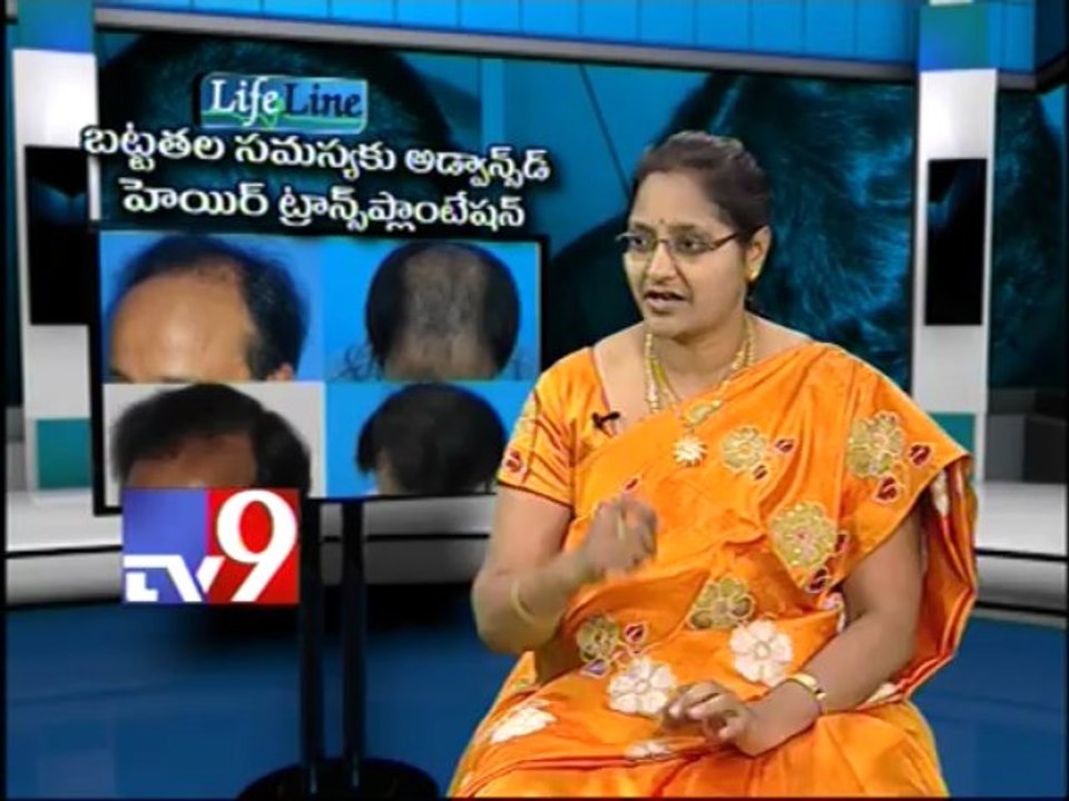 Baldness treated with Advanced Hair transplantation