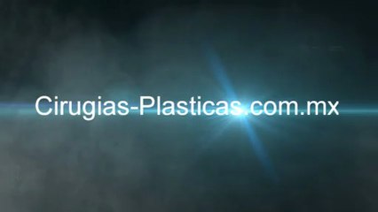 Rinoplastia Antes y Despues - Cirugia Plastica Fotos