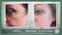 Nerium AD Review | Nerium Reviews Before and After Pics