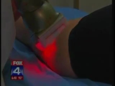 Cellulite - High Tech Cellulite Treatments