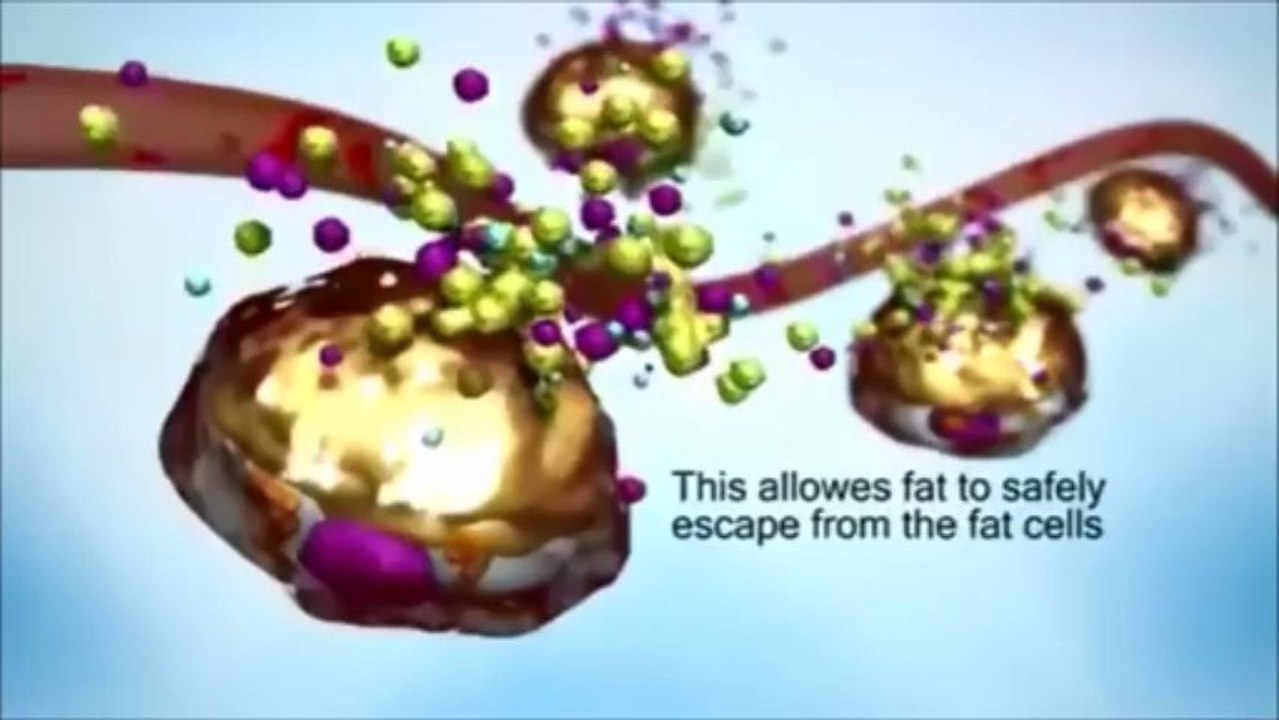 How i-Lipo Works