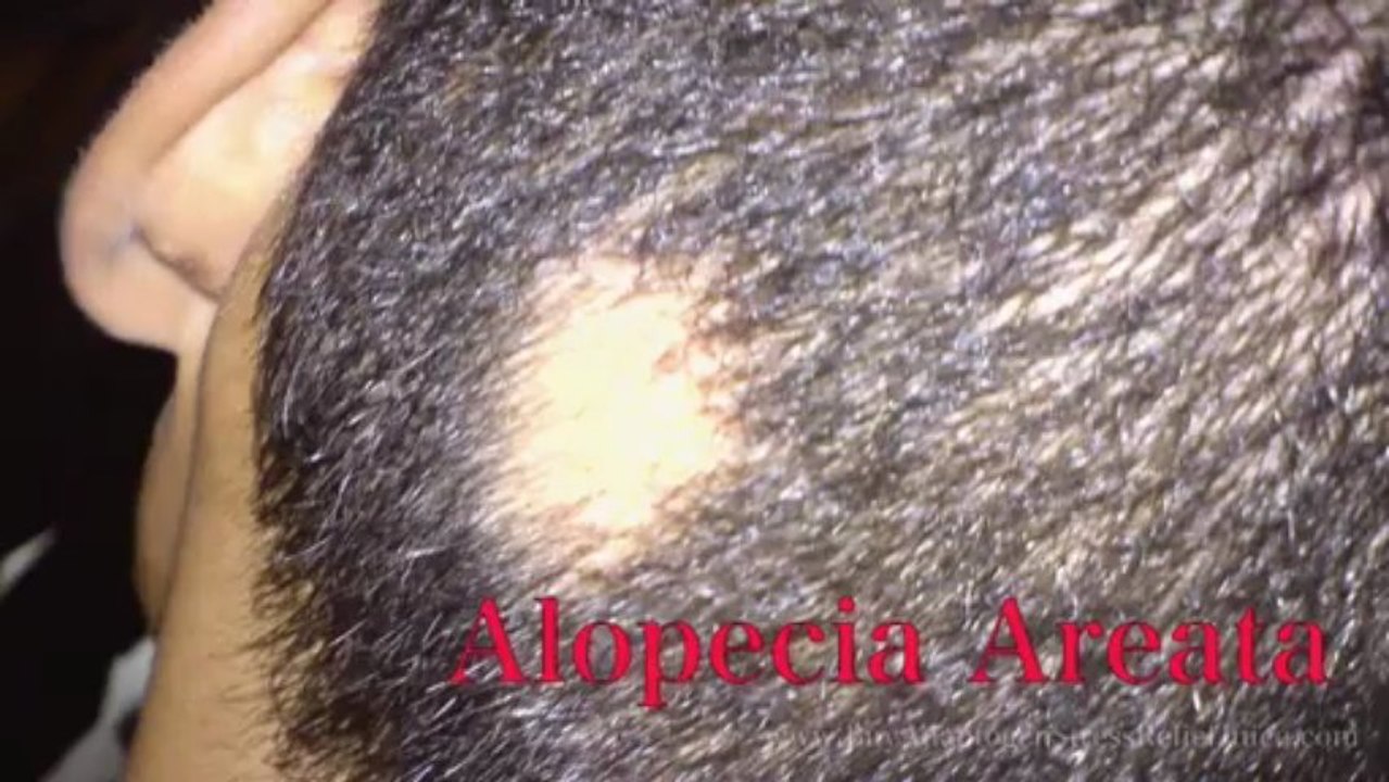 Physical Symptoms of Stress