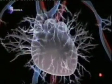 Strippers: Electrocucion en cadena