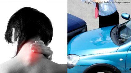 Whiplash claims made easy