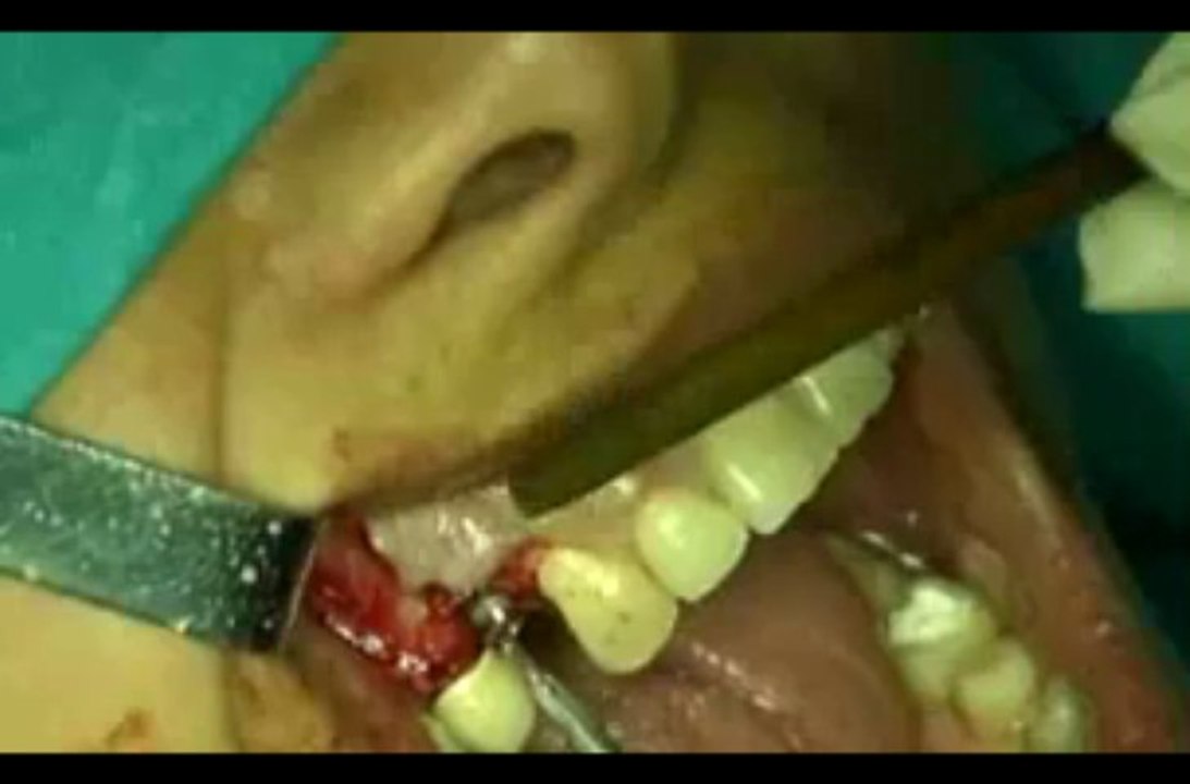 Abid Faqir - oral surgery - Abid Faqir