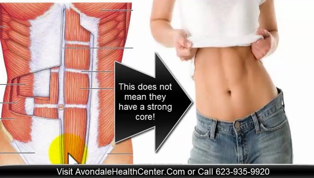 Core Strengthening Exercises in Avondale, AZ