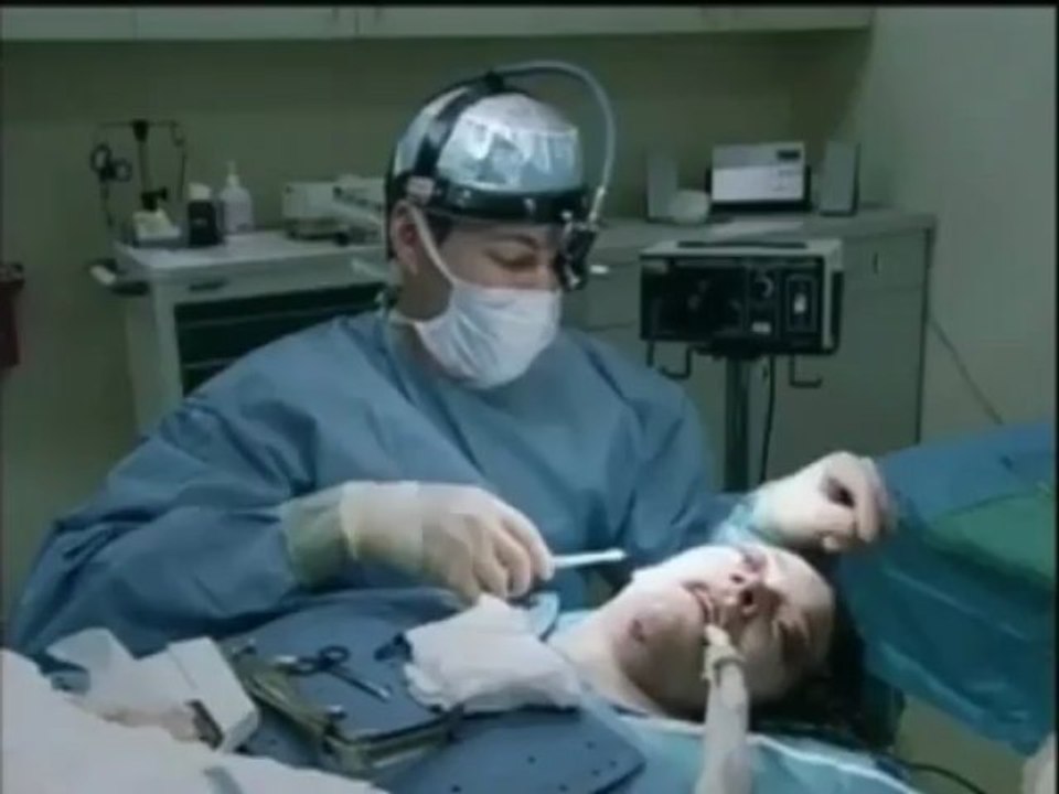 Dr Jason Diamond Reviews the Art of the Facelifton Dr 90210