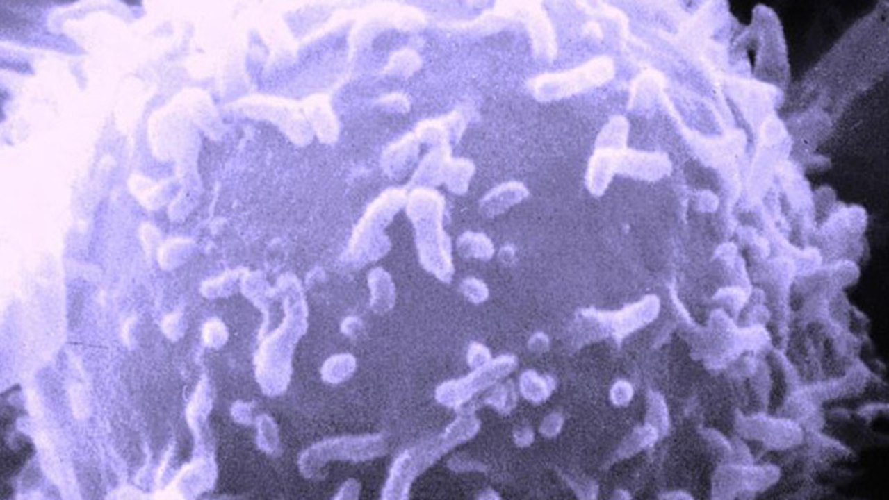 Scientists Discover Way To Keep Cancer From Spreading?