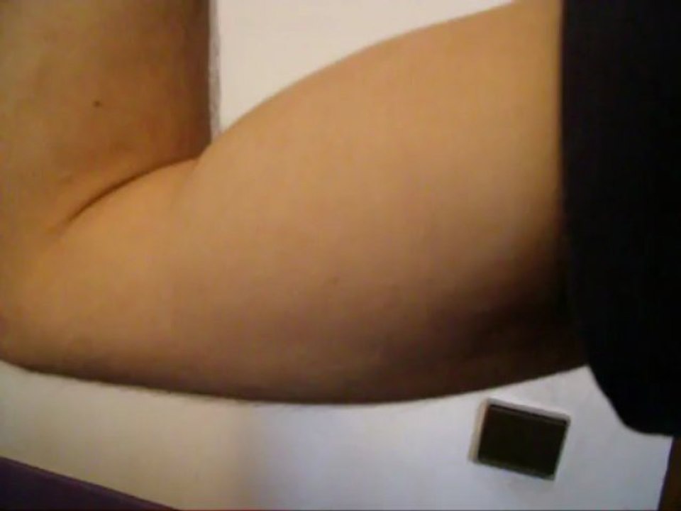 Microcontracture au biceps