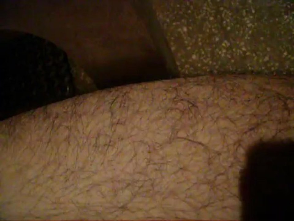 Microcontracture à la cuisse