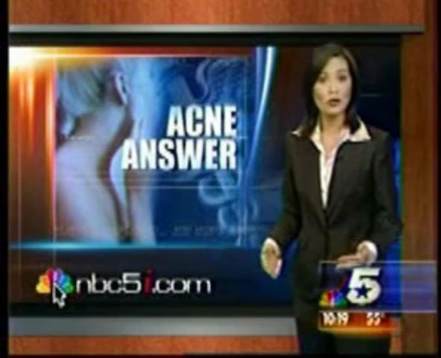Acne Scars