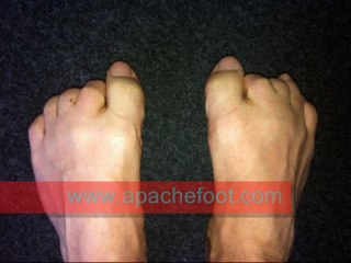 Apache Foot and Ankle Specialists