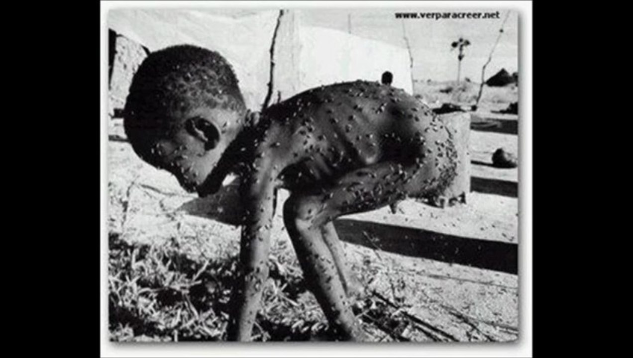 Itinérance et pauvreté - 4 - Pauvreté - Enfants