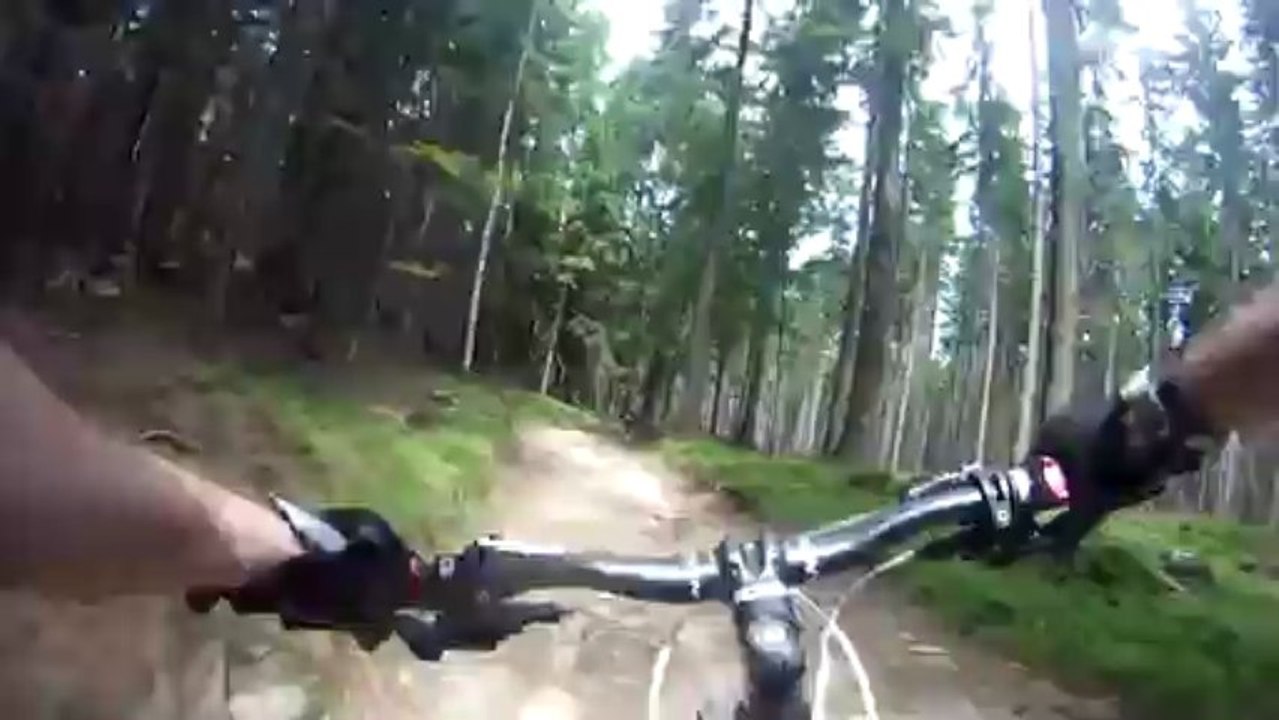 mtb-aga