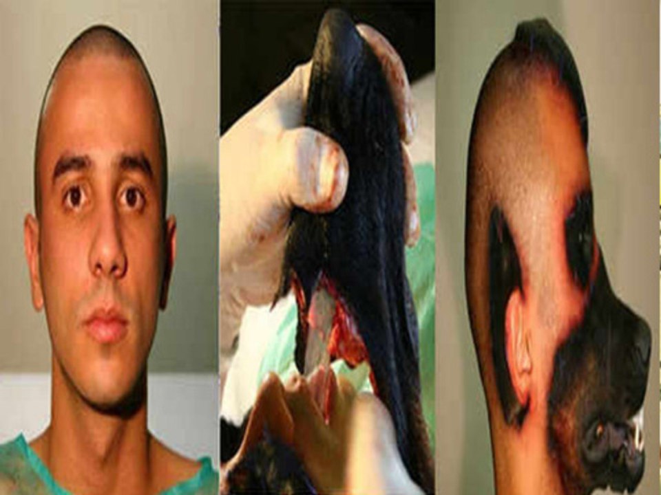 WTF  A Man Gets Dog Face by Plastic Surgery