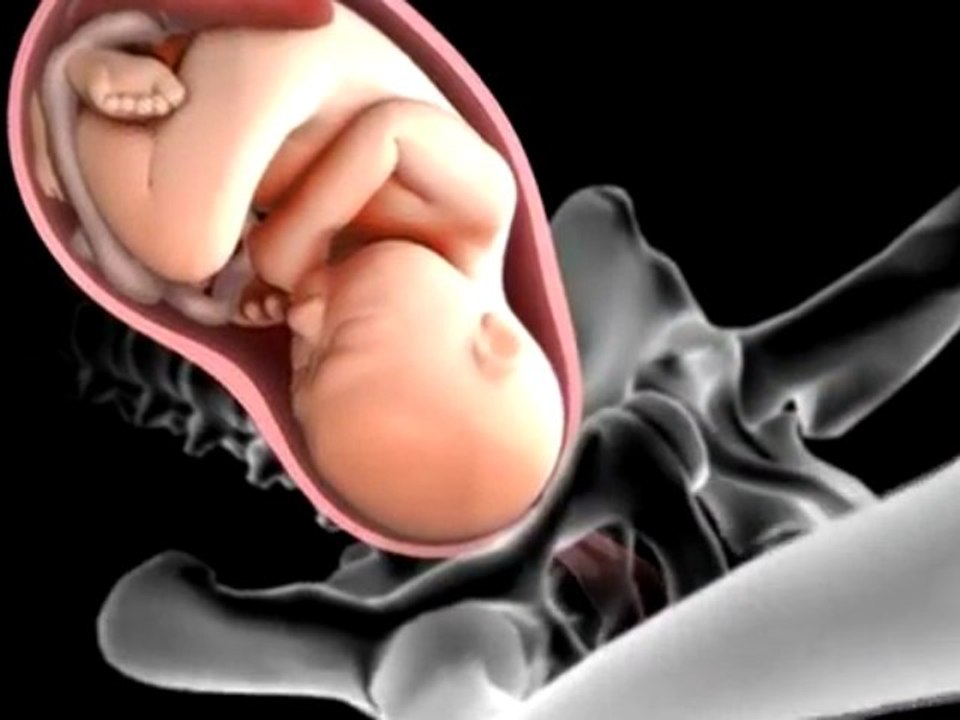 Accouchement en vidéo  Le bébé lors de l'accouchement