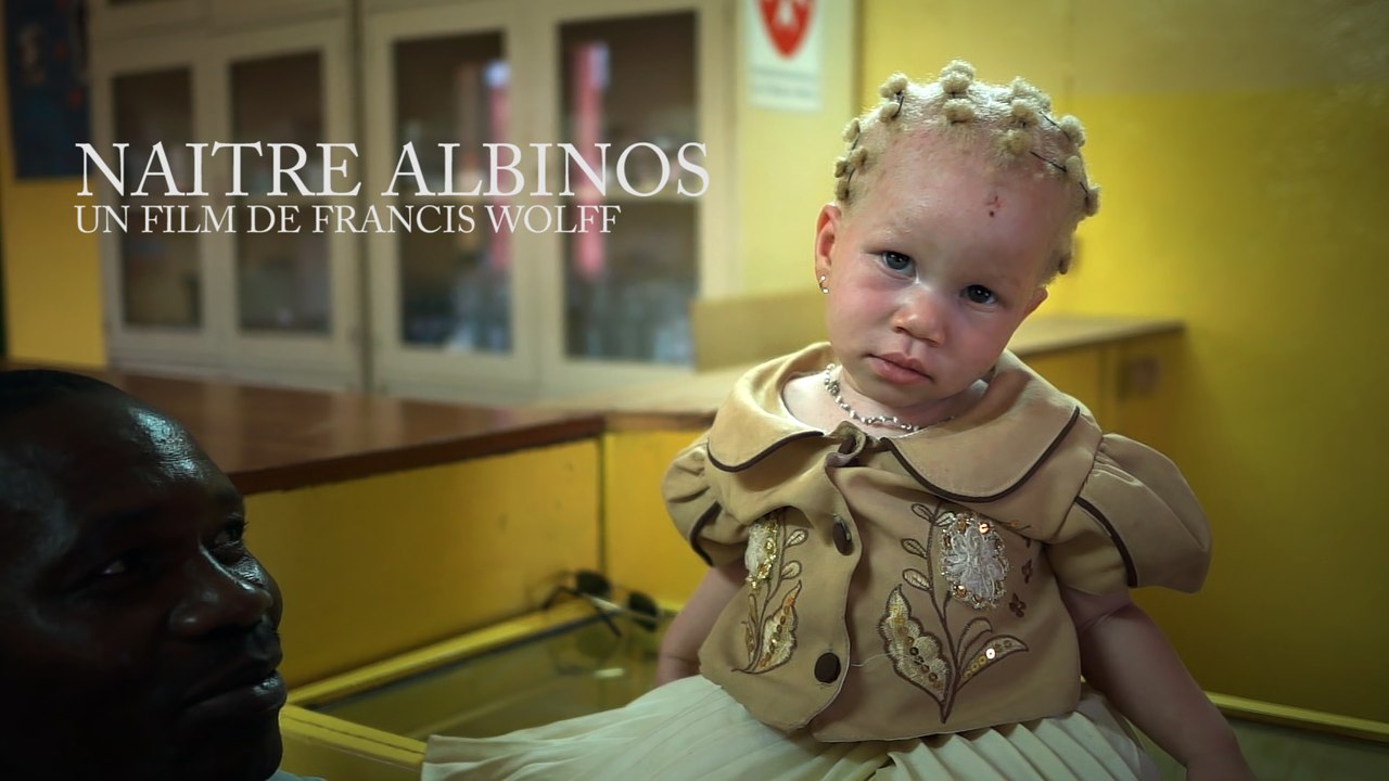 NAITRE ALBINOS