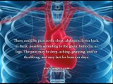 Aneurysm Heart Symptoms - What Are The Aneurysm Heart Symptoms?