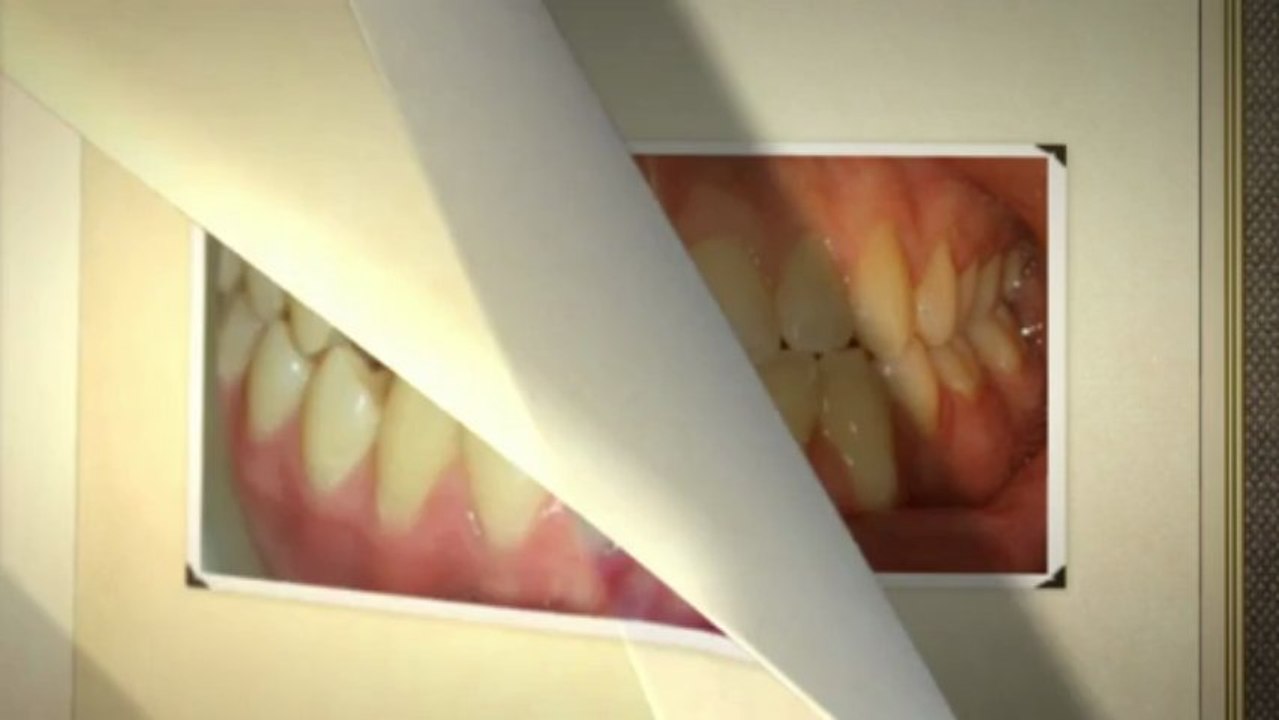 Colorado Springs Orthodontist Apr2013