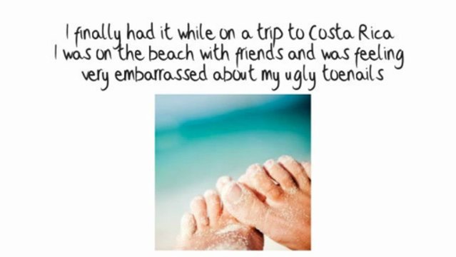 How To Cure Nail Fungus Infections: Best Toe Nail Fungus Treatments That Work