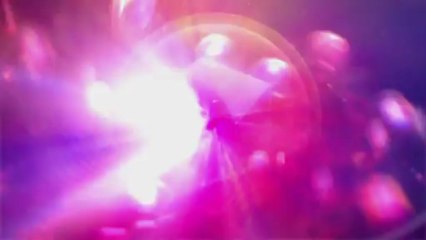 direct metal laser sintering