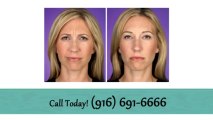 Botox Elk grove CA - Dr. Mahmoud Khattab, M.D.