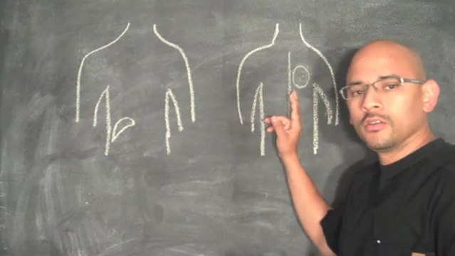 Personal Injury Doctor Atlanta - How the Gallbladder Causes Back Pain - Car Accident Doctor Atlanta - Atlanta Chiropractor - Car Accident Doctor Gainesville GA - Personal Injury Doctor Gainesville GA - Chiropractor Gainesville GA