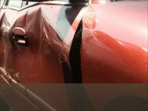 Physical Therapy Bronx NY | Bronx Physical Therapy