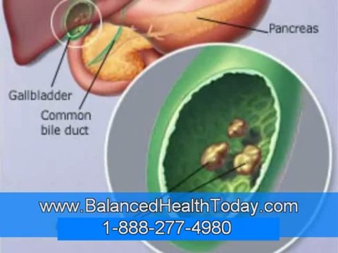 Heavy Metals Body Cleanse, Heavy Metal Poisoning