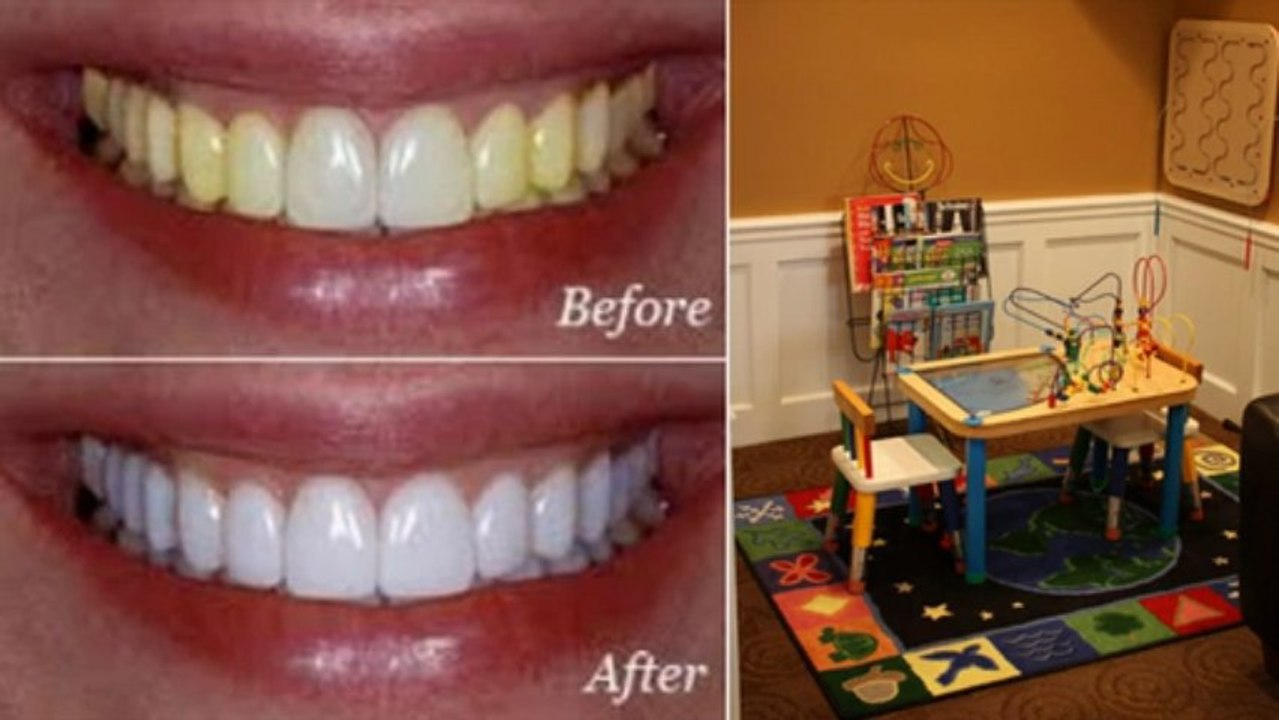 Invisalign Glenview, IL