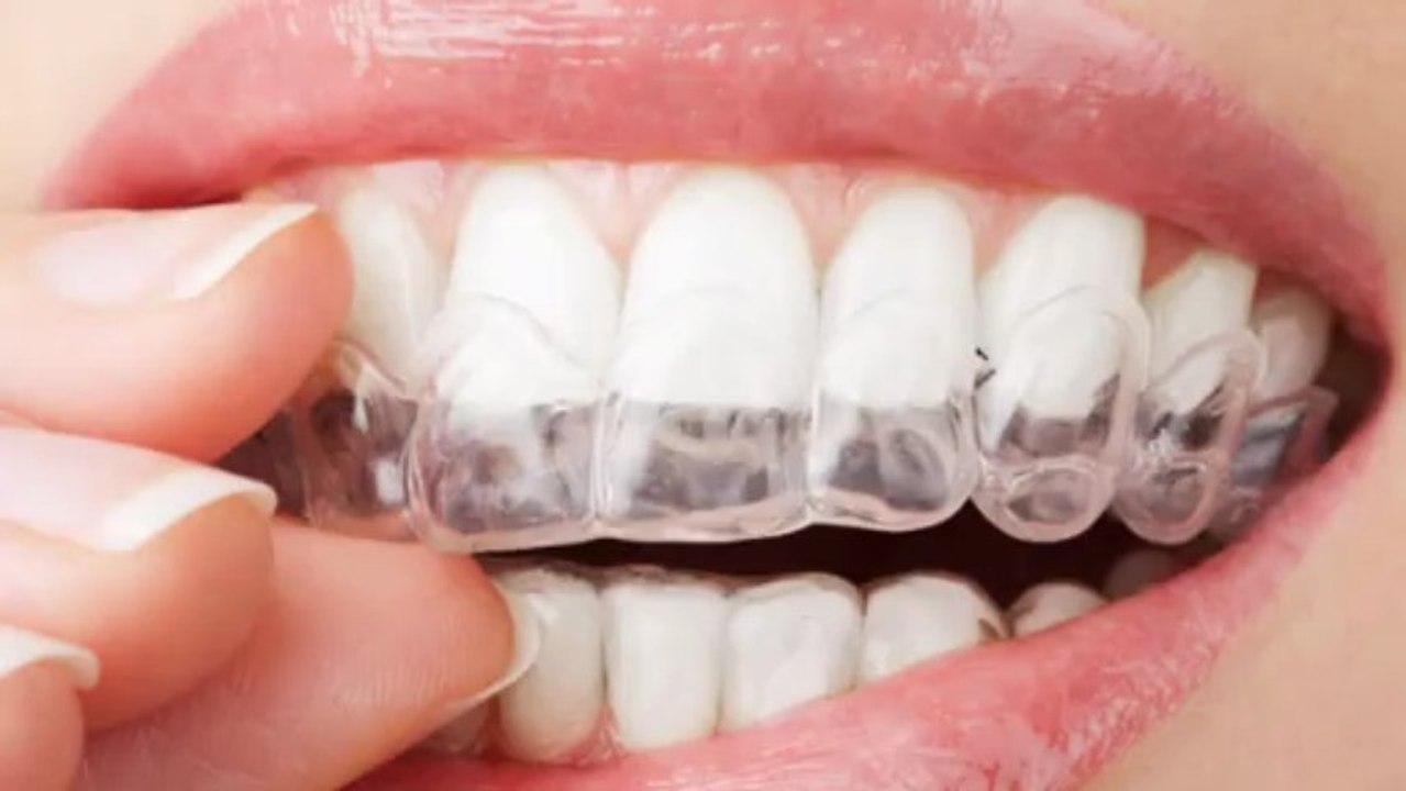 Get Beutiful Smile