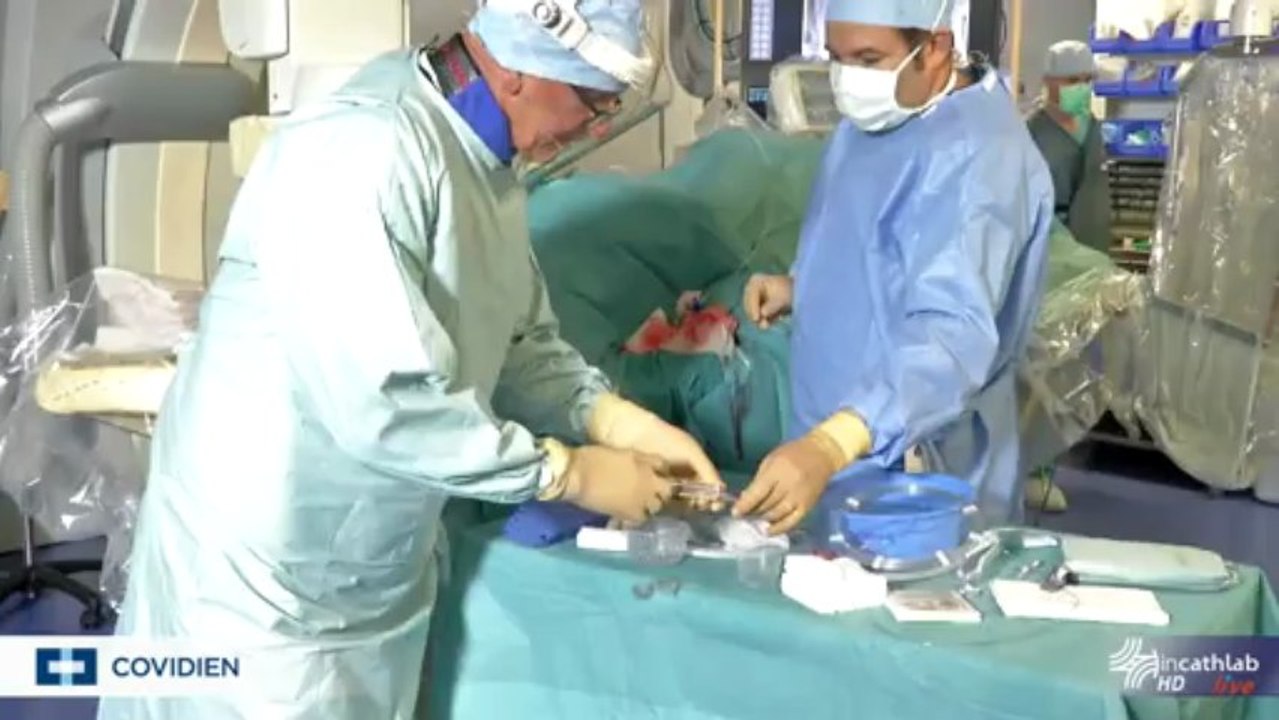 Peripheral angioplasties of complex cases: usefulness of unusual approaches